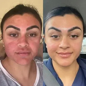 Prima dopo 4