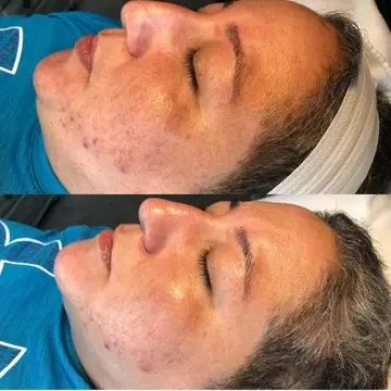 Prima dopo 5